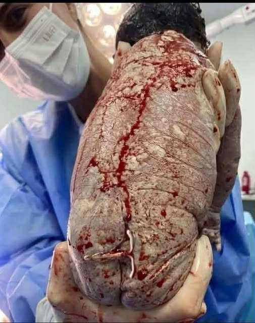 att.GX0smHepq_DSvraEiHYCrcFzLT9D0lM8M088LF5lEdI